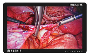 Surgical Displays and Large Format Displays
