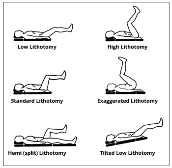 Lithotomy Positions