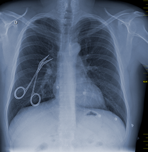 unintended retained surgical items can lead to x-rays, reoperation, and even death for a patient