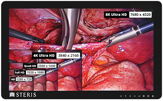 Medical Imaging Screen Sizes