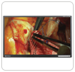 Link to Vividimage W High-Definition Wall Displays