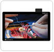 Wireless Vividimage D Surgical Display