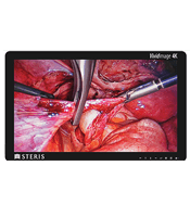 Link to Surgical Displays