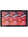 Upgrade your Operating Room To 4K