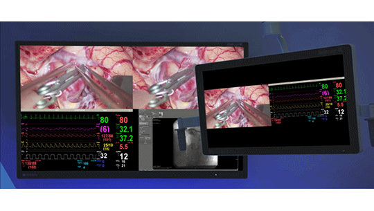 HexaVue Integration System offers 4K visualization