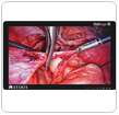 Link to Surgical Displays