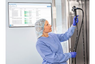 SPM Endoscope Tracking Software