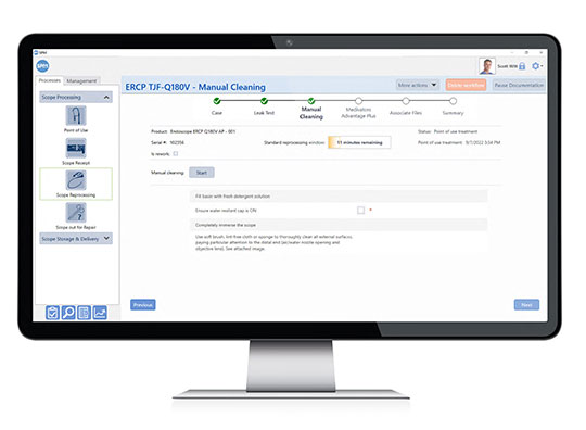 SPM Endo Workflow Computer Screen