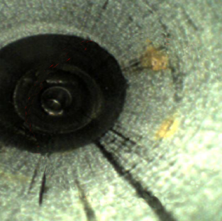 Example of discoloration in endoscopes