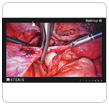 Link to Surgical Displays and Large Format Displays
