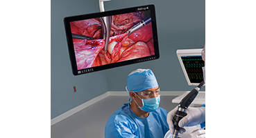 Vividimage 4K Surgical Display
