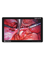 Vividimage 4K Surgical Display