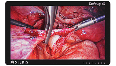 surgical grade monitor with 4K visualization