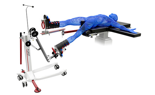 PURIST Orthopedic Leg Positioning System