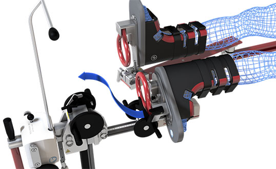 PURIST Orthopedic Leg Positioning System
