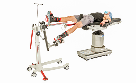 PURIST Leg Positioning System