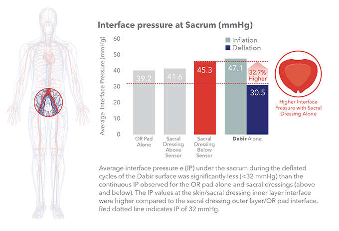 Interface Pressure at Sacrum bar chart