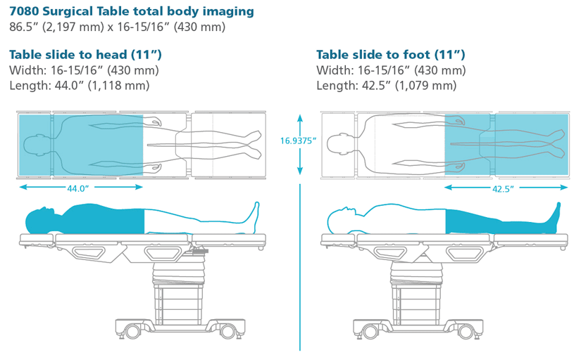 7080 General Surgical Table Sizing Chart